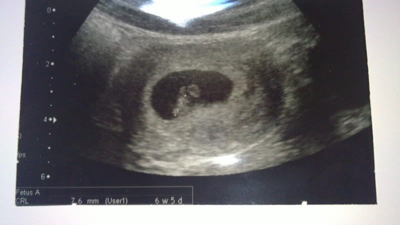 02092010425.jpg